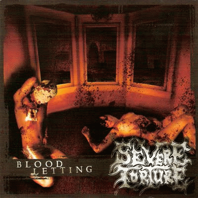 Severe Torture : Bloodletting